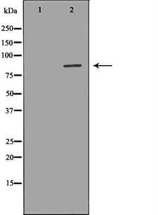 AOC3 / VAP-1 Antibody - Western blot analysis of A549 whole cells lysates using AOC3 antibody. The lane on the left is treated with the antigen-specific peptide.