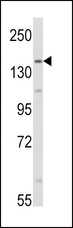 AOX1 / Aldehyde Oxidase Antibody - Western blot of AOX1 Antibody in HepG2 cell line lysates (35 ug/lane). AOX1 (arrow) was detected using the purified antibody.