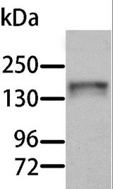 AOX1 / Aldehyde Oxidase Antibody - Western blot analysis of Human liver tissue, using AOX1 Polyclonal Antibody at dilution of 1:1000.