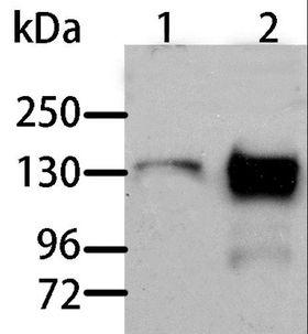 AOX1 / Aldehyde Oxidase Antibody - Western blot analysis of Human liver cancer and normal liver tissue, using AOX1 Polyclonal Antibody at dilution of 1:1000.