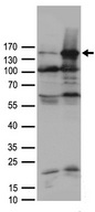 AOX1 / Aldehyde Oxidase Antibody - HEK293T cells were transfected with the pCMV6-ENTRY control. (Left lane) or pCMV6-ENTRY AOX1. (Right lane) cDNA for 48 hrs and lysed