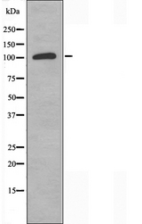 AOX1 / Aldehyde Oxidase Antibody - Western blot analysis of extracts of HeLa cells using AOX1 antibody.