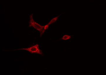 AOX1 / Aldehyde Oxidase Antibody - Staining HeLa cells by IF/ICC. The samples were fixed with PFA and permeabilized in 0.1% Triton X-100, then blocked in 10% serum for 45 min at 25°C. The primary antibody was diluted at 1:200 and incubated with the sample for 1 hour at 37°C. An Alexa Fluor 594 conjugated goat anti-rabbit IgG (H+L) antibody, diluted at 1/600, was used as secondary antibody.