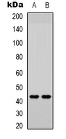 AP-1 / JUND Antibody - Western blot analysis of JUND (pS255) expression in Jurkat (A); HEK293T (B) whole cell lysates.