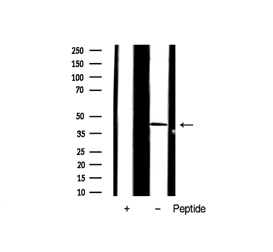 AP-1 / JUND Antibody - Western blot analysis of JunD expression in K562 whole cells lysates. The lane on the left is treated with the antigen-specific peptide.