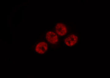 AP-1 / JUND Antibody - Staining HeLa cells by IF/ICC. The samples were fixed with PFA and permeabilized in 0.1% Triton X-100, then blocked in 10% serum for 45 min at 25°C. The primary antibody was diluted at 1:200 and incubated with the sample for 1 hour at 37°C. An Alexa Fluor 594 conjugated goat anti-rabbit IgG (H+L) Ab, diluted at 1/600, was used as the secondary antibody.