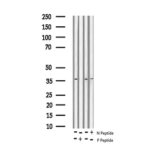 AP-1 / JUND Antibody - Western blot analysis of Phospho-JunD (Ser255) expression in various lysates