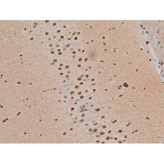 AP-1 / JUND Antibody - 1:200 staining mouse brain tissue by IHC-P. The tissue was formaldehyde fixed and a heat mediated antigen retrieval step in citrate buffer was performed. The tissue was then blocked and incubated with the antibody for 1.5 hours at 22°C. An HRP conjugated goat anti-rabbit antibody was used as the secondary.