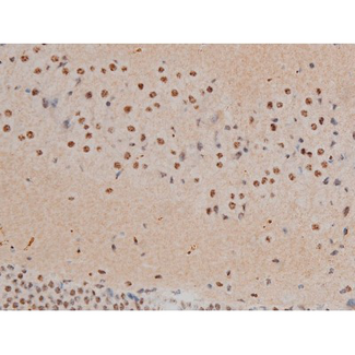 AP-1 / JUND Antibody - 1:200 staining mouse brain tissue by IHC-P. The tissue was formaldehyde fixed and a heat mediated antigen retrieval step in citrate buffer was performed. The tissue was then blocked and incubated with the antibody for 1.5 hours at 22°C. An HRP conjugated goat anti-rabbit antibody was used as the secondary.