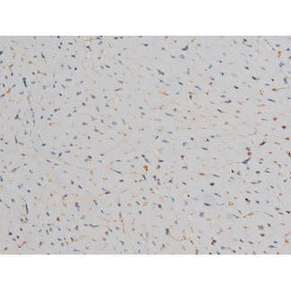AP-1 / JUND Antibody - 1:200 staining mouse heart tissue by IHC-P. The tissue was formaldehyde fixed and a heat mediated antigen retrieval step in citrate buffer was performed. The tissue was then blocked and incubated with the antibody for 1.5 hours at 22°C. An HRP conjugated goat anti-rabbit antibody was used as the secondary.