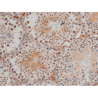AP-1 / JUND Antibody - 1:200 staining mouse testis tissue by IHC-P. The tissue was formaldehyde fixed and a heat mediated antigen retrieval step in citrate buffer was performed. The tissue was then blocked and incubated with the antibody for 1.5 hours at 22°C. An HRP conjugated goat anti-rabbit antibody was used as the secondary.