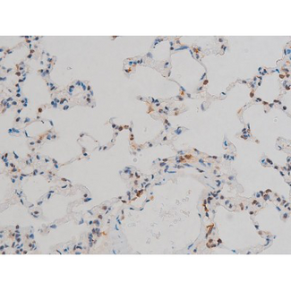 AP-1 / JUND Antibody - 1:200 staining rat lung tissue by IHC-P. The tissue was formaldehyde fixed and a heat mediated antigen retrieval step in citrate buffer was performed. The tissue was then blocked and incubated with the antibody for 1.5 hours at 22°C. An HRP conjugated goat anti-rabbit antibody was used as the secondary.