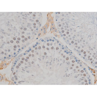 AP-1 / JUND Antibody - 1:200 staining rat testis tissue by IHC-P. The tissue was formaldehyde fixed and a heat mediated antigen retrieval step in citrate buffer was performed. The tissue was then blocked and incubated with the antibody for 1.5 hours at 22°C. An HRP conjugated goat anti-rabbit antibody was used as the secondary.
