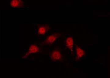 AP-1 / JUND Antibody - Staining K562 cells by IF/ICC. The samples were fixed with PFA and permeabilized in 0.1% Triton X-100, then blocked in 10% serum for 45 min at 25°C. The primary antibody was diluted at 1:200 and incubated with the sample for 1 hour at 37°C. An Alexa Fluor 594 conjugated goat anti-rabbit IgG (H+L) Ab, diluted at 1/600, was used as the secondary antibody.