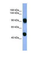 AP1B1 / BAM22 Antibody - AP1B1 antibody Western blot of Fetal Muscle lysate.  This image was taken for the unconjugated form of this product. Other forms have not been tested.