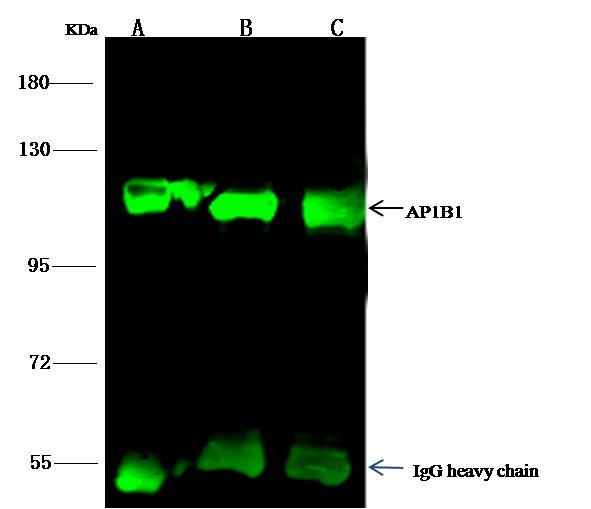 AP1B1 / BAM22 Antibody - AP1B1 was immunoprecipitated using: Lane A: 0.5 mg NIH-3T3 Whole Cell Lysate. Lane B: 0.5 mg K562 Whole Cell Lysate. Lane C:0.5 mg Hela Whole Cell Lysate. 1 uL anti-AP1B1 rabbit polyclonal antibody and 15 ul of 50% Protein G agarose. Primary antibody: Anti-AP1B1 rabbit polyclonal antibody, at 1:500 dilution. Secondary antibody: Dylight 800-labeled antibody to rabbit IgG (H+L), at 1:5000 dilution. Developed using the odssey technique. Performed under reducing conditions. Predicted band size: 105 kDa. Observed band size: 112 kDa.