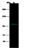 AP1B1 / BAM22 Antibody - Anti-AP1B1 rabbit polyclonal antibody at 1:500 dilution. Lane A: NIH3T3 Whole Cell Lysate. Lysates/proteins at 10 ug per lane. Secondary: Goat Anti-Rabbit IgG H&L (Dylight 800) at 1/10000 dilution. Developed using the Odyssey technique. Performed under reducing conditions. Predicted band size: 105 kDa. Observed band size: 105 kDa.