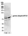 AP1G1 / Adaptin Gamma 1 Antibody - Detection of mouse gamma Adaptin/AP1G1 by western blot. Samples: Whole cell lysate (50 µg) from TCMK-1 and NIH 3T3 cells prepared using NETN lysis buffer. Antibody: Affinity purified rabbit anti-gamma Adaptin/AP1G1 antibody used for WB at 0.1 µg/ml. Detection: Chemiluminescence with an exposure time of 30 seconds.
