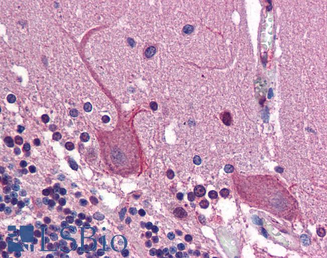 AP1G1 / Adaptin Gamma 1 Antibody - Anti-AP1G1 / Gamma Adaptin antibody IHC of human brain, cerebellum. Immunohistochemistry of formalin-fixed, paraffin-embedded tissue after heat-induced antigen retrieval. Antibody concentration 2.5 ug/ml.  This image was taken for the unconjugated form of this product. Other forms have not been tested.