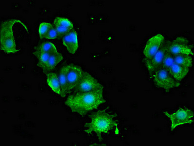 AP1G1 / Adaptin Gamma 1 Antibody - Immunofluorescent analysis of MCF-7 cells diluted at 1:100 and Alexa Fluor 488-congugated AffiniPure Goat Anti-Rabbit IgG(H+L)