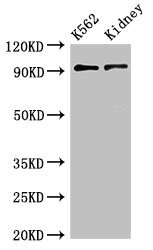 AP1G1 / Adaptin Gamma 1 Antibody - Western Blot Positive WB detected in:K562 whole cell lysate,Mouse kidney tissue All Lanes:AP1G1 antibody at 3.4µg/ml Secondary Goat polyclonal to rabbit IgG at 1/50000 dilution Predicted band size: 92 KDa Observed band size: 92 KDa