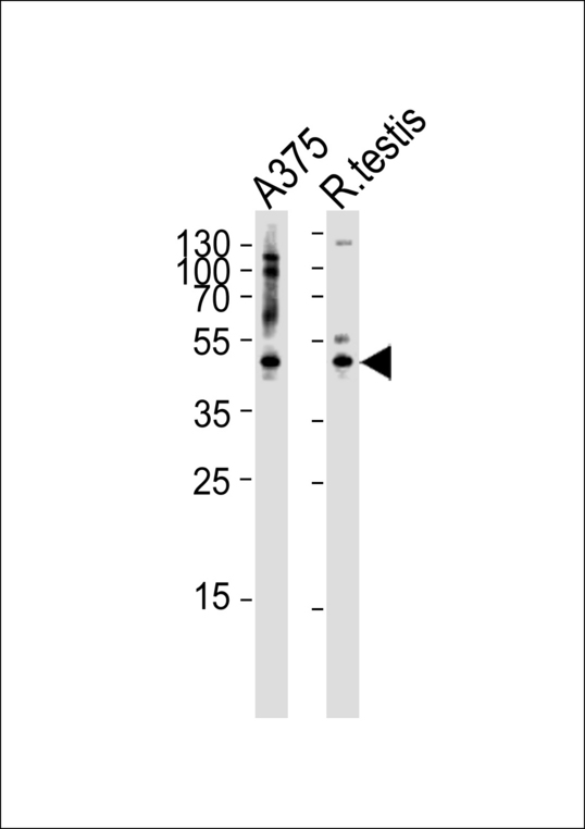 AP1M1 Antibody - Western blot of lysates from A375 cell line and rat testis tissue lysate(from left to right), using AP1M1 Antibody. Antibody was diluted at 1:1000 at each lane. A goat anti-rabbit IgG H&L (HRP) at 1:5000 dilution was used as the secondary antibody. Lysates at 35ug per lane.