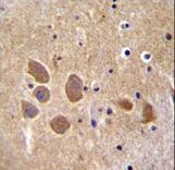AP1M1 Antibody - AP1M1 Antibody immunohistochemistry of formalin-fixed and paraffin-embedded human brain tissue followed by peroxidase-conjugated secondary antibody and DAB staining.