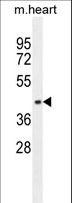 AP1M1 Antibody - AP1M1 Antibody western blot of mouse heart tissue lysates (35 ug/lane). The AP1M1 antibody detected the AP1M1 protein (arrow).