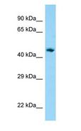 AP1M1 Antibody - AP1M1 antibody Western Blot of Human Lung.  This image was taken for the unconjugated form of this product. Other forms have not been tested.