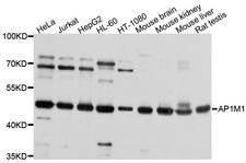 AP1M1 Antibody - Western blot analysis of extracts of various cell lines, using AP1M1 antibody at 1:1000 dilution. The secondary antibody used was an HRP Goat Anti-Rabbit IgG (H+L) at 1:10000 dilution. Lysates were loaded 25ug per lane and 3% nonfat dry milk in TBST was used for blocking. An ECL Kit was used for detection and the exposure time was 30s.