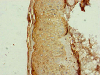 AP1M1 Antibody - Immunohistochemistry of paraffin-embedded human skin tissue at dilution of 1:100