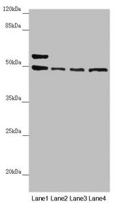 AP1M1 Antibody - Western blot All Lanes:AP1M1 antibody at 1.43 ug/ml Lane 1: A375 whole cell lysate Lane 2: Jurkat whole cell lysate Lane 3: Hela whole cell lysate Lane 4: HepG-2 whole cell lysate Secondary Goat polyclonal to rabbit IgG at 1/10000 dilution Predicted band size: 49,50 kDa Observed band size: 49,57 kDa