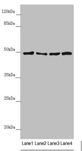 AP1M1 Antibody - Western blot All Lanes:AP1M1 antibody at 1.38 ug/ml Lane 1: A375 whole cell lysate Lane 2: Jurkat whole cell lysate Lane 3: Hela whole cell lysate Lane 4: HepG-2 whole cell lysate Secondary Goat polyclonal to rabbit IgG at 1/10000 dilution Predicted band size: 49,50 kDa Observed band size: 49 kDa