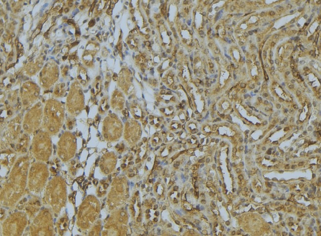 AP1M1 Antibody - 1:100 staining mouse kidney tissue by IHC-P. The sample was formaldehyde fixed and a heat mediated antigen retrieval step in citrate buffer was performed. The sample was then blocked and incubated with the antibody for 1.5 hours at 22°C. An HRP conjugated goat anti-rabbit antibody was used as the secondary.