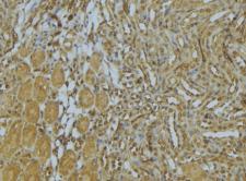 AP1M1 Antibody - 1:100 staining mouse kidney tissue by IHC-P. The sample was formaldehyde fixed and a heat mediated antigen retrieval step in citrate buffer was performed. The sample was then blocked and incubated with the antibody for 1.5 hours at 22°C. An HRP conjugated goat anti-rabbit antibody was used as the secondary.