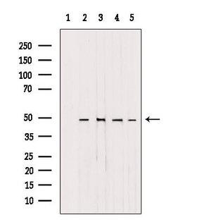 AP1M1 Antibody - Western blot analysis of extracts of various samples using AP1M1 antibody. Lane 1: rat heart treated with blocking peptide. Lane 2: rat heart; Lane 3: mouse brain; Lane 4: HepG2; Lane 5: B16F10;