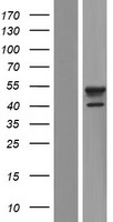 AP1M1 Protein - Western validation with an anti-DDK antibody * L: Control HEK293 lysate R: Over-expression lysate