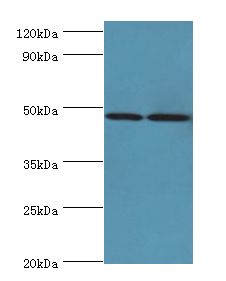 AP1M2 Antibody - Western blot. All lanes: AP1M2 antibody at 2 ug/ml. Lane 1: mouse small intestine tissue. Lane 2: mouse kidney tissue. Secondary antibody: Goat polyclonal to rabbit at 1:10000 dilution. Predicted band size: 48 kDa. Observed band size: 48 kDa.