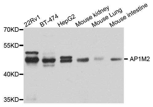AP1M2 Antibody - Western blot analysis of extract of various cells.
