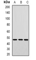 AP1M2 Antibody - Western blot analysis of AP1-mu-2 expression in HepG2 (A); mouse kidney (B); mouse lung (C) whole cell lysates.