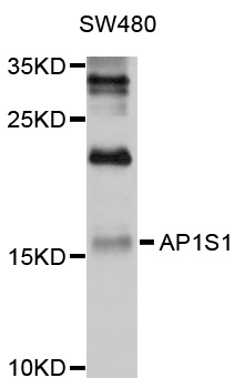 AP1S1 Antibody - Western blot analysis of extracts of SW480 cells, using AP1S1 antibody at 1:1000 dilution. The secondary antibody used was an HRP Goat Anti-Rabbit IgG (H+L) at 1:10000 dilution. Lysates were loaded 25ug per lane and 3% nonfat dry milk in TBST was used for blocking. An ECL Kit was used for detection and the exposure time was 60s.