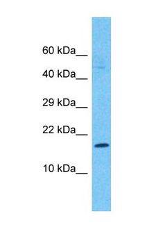 AP1S2 Antibody - Western blot of AP1S2 Antibody with human Stomach Tumor lysate.  This image was taken for the unconjugated form of this product. Other forms have not been tested.