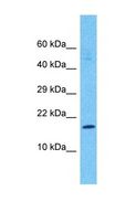 AP1S2 Antibody - Western blot of AP1S2 Antibody with human Stomach Tumor lysate.  This image was taken for the unconjugated form of this product. Other forms have not been tested.