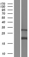AP1S2 Protein - Western validation with an anti-DDK antibody * L: Control HEK293 lysate R: Over-expression lysate