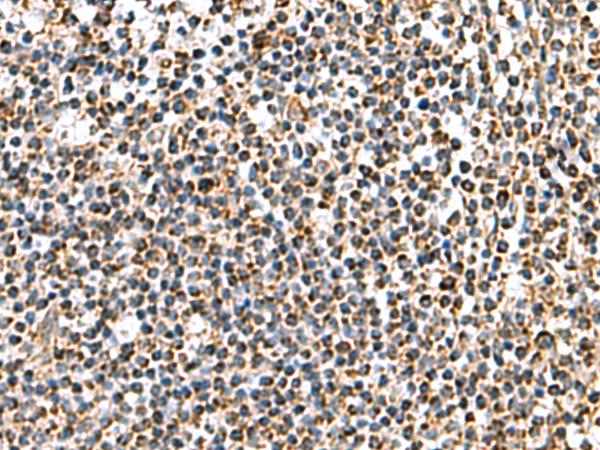 AP1S3 Antibody - Immunohistochemistry of paraffin-embedded Human tonsil tissue  using AP1S3 Polyclonal Antibody at dilution of 1:70(×200)
