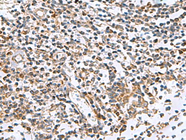 AP1S3 Antibody - Immunohistochemistry of paraffin-embedded Human tonsil tissue  using AP1S3 Polyclonal Antibody at dilution of 1:55(×200)