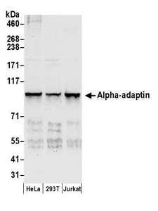 AP2A1 / AP2-Alpha Antibody - Detection of human Alpha-adaptin by western blot. Samples: Whole cell lysate (50 µg) from HeLa, HEK293T, and Jurkat cells prepared using NETN lysis buffer. Antibodies: Affinity purified rabbit anti-Alpha-adaptin antibody used for WB at 0.1 µg/ml. Detection: Chemiluminescence with an exposure time of 10 seconds.