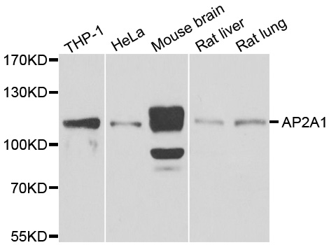 AP2A1 / AP2-Alpha Antibody - Western blot analysis of extracts of various cell lines.