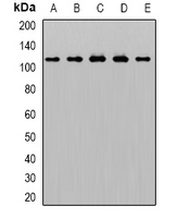 AP2A1 / AP2-Alpha Antibody - Western blot analysis of AP2-alpha-1 expression in THP1 (A); HeLa (B); mouse brain (C); rat liver (D); rat lung (E) whole cell lysates.
