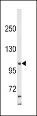 AP2A2 Antibody - Western blot of AP2A2 Antibody in HepG2 cell line lysates (35 ug/lane). AP2A2 (arrow) was detected using the purified antibody.